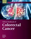Oxford Textbook of Colorectal Cancer cover