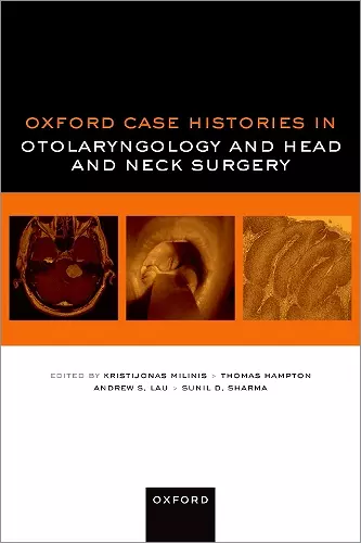 Oxford Case Histories in Otolaryngology and Head and Neck Surgery cover