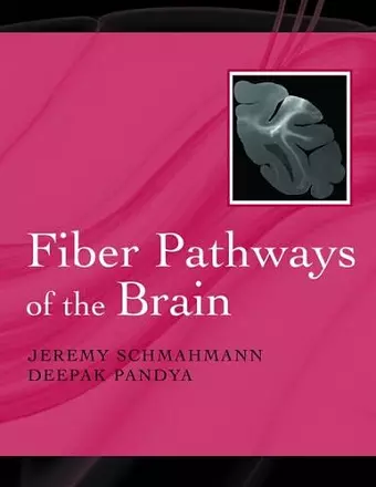 Fiber Pathways of the Brain cover