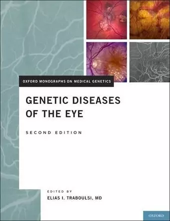 Genetic Diseases of the Eye cover
