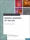 Genetic Diseases of the Eye cover