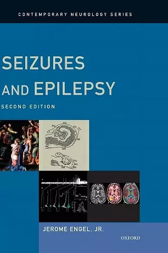 Seizures and Epilepsy cover