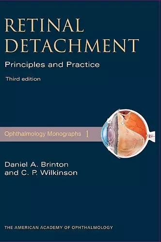 Retinal Detachment cover