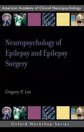 Neuropsychology of Epilepsy and Epilepsy Surgery cover