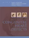 Congenital Heart Defects cover