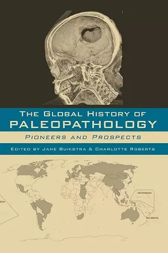 The Global History of Paleopathology cover