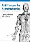 Radial Access for Neurointervention cover