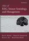 Atlas of EEG, Seizure Semiology, and Management cover