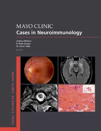 Mayo Clinic Cases in Neuroimmunology cover