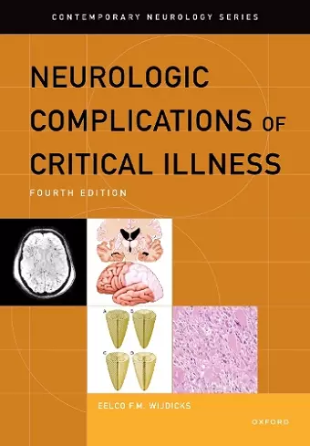 Neurologic Complications of Critical Illness cover