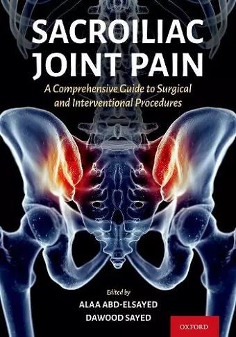 Sacroiliac Joint Pain cover