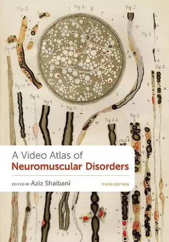 A Video Atlas of Neuromuscular Disorders cover
