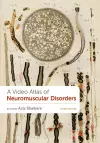 A Video Atlas of Neuromuscular Disorders cover