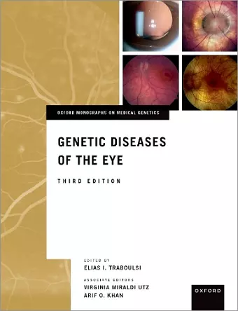 Genetic Diseases of the Eye cover