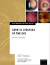 Genetic Diseases of the Eye cover