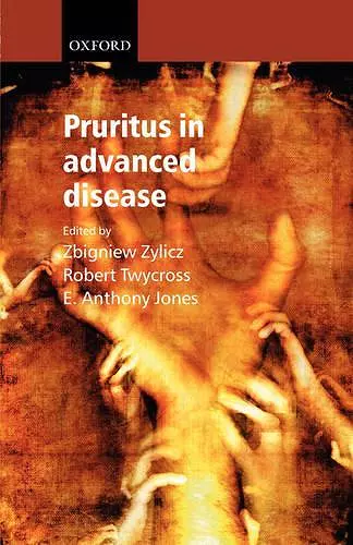 Pruritus in Advanced Disease cover