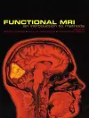 Functional Magnetic Resonance Imaging cover