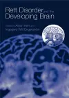 Rett Disorder and the Developing Brain cover