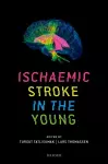 Ischaemic Stroke in the Young cover