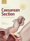 Textbook of Caesarean Section cover