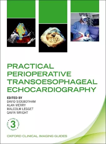 Practical Perioperative Transoesophageal Echocardiography cover