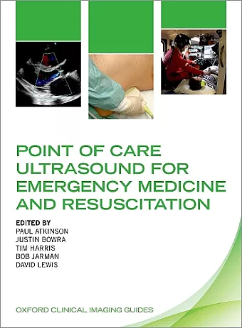 Point of Care Ultrasound for Emergency Medicine and Resuscitation cover