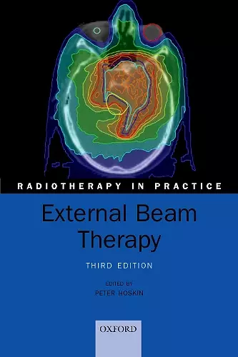 External Beam Therapy cover