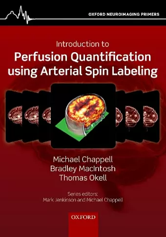 Introduction to Perfusion Quantification using Arterial Spin Labelling cover