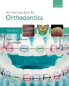 An Introduction to Orthodontics cover