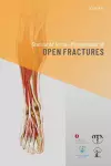 Standards for the Management of Open Fractures cover