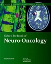 Oxford Textbook of Neuro-Oncology cover
