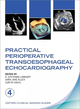 Practical Perioperative Transoesophageal Echocardiography cover