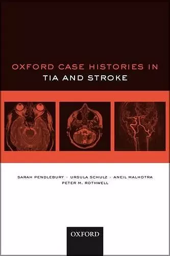 Oxford Case Histories in TIA and Stroke cover