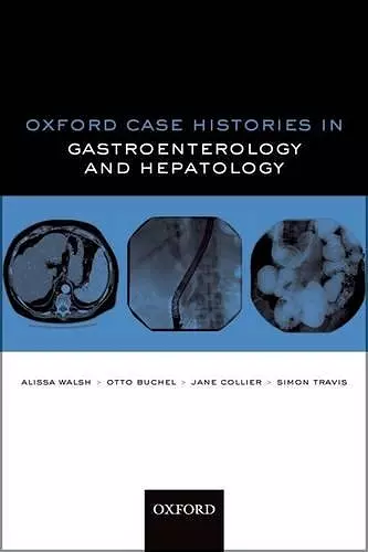 Oxford Case Histories in Gastroenterology and Hepatology cover