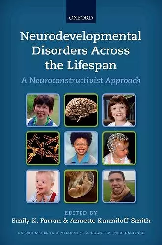 Neurodevelopmental Disorders Across the Lifespan cover