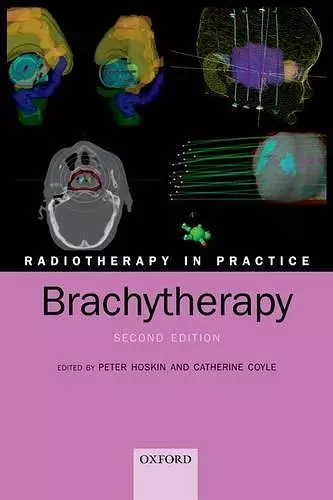 Radiotherapy in Practice - Brachytherapy cover