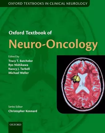 Oxford Textbook of Neuro-Oncology cover