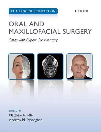 Challenging Concepts in Oral and Maxillofacial Surgery cover