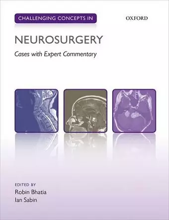 Challenging Concepts in Neurosurgery cover