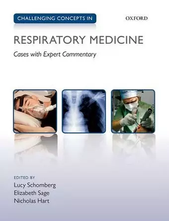 Challenging Concepts in Respiratory Medicine cover