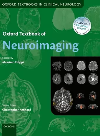 Oxford Textbook of Neuroimaging cover