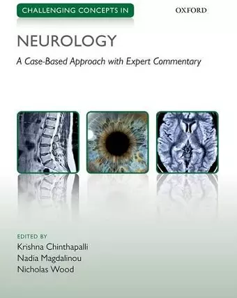 Challenging Concepts in Neurology cover