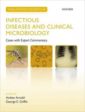 Challenging Concepts in Infectious Diseases and Clinical Microbiology cover