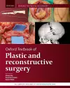 Oxford Textbook of Plastic and Reconstructive Surgery cover