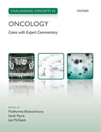 Challenging Concepts in Oncology cover