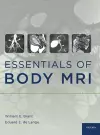 Essentials of Body MRI cover