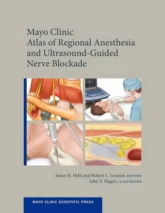 Mayo Clinic Atlas of Regional Anesthesia and Ultrasound-Guided Nerve Blockade cover