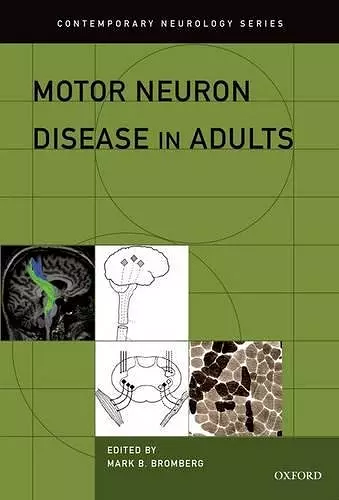 Motor Neuron Disease in Adults cover