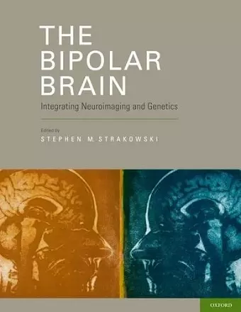 The Bipolar Brain cover