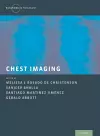 Chest Imaging cover